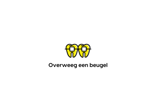 overweeg een beugel